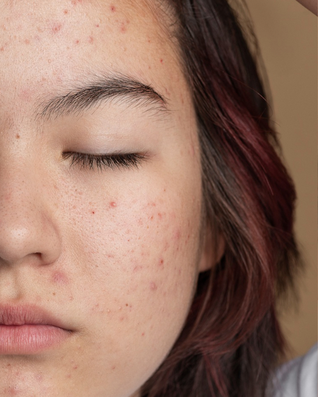 Mega Menu Banner7782