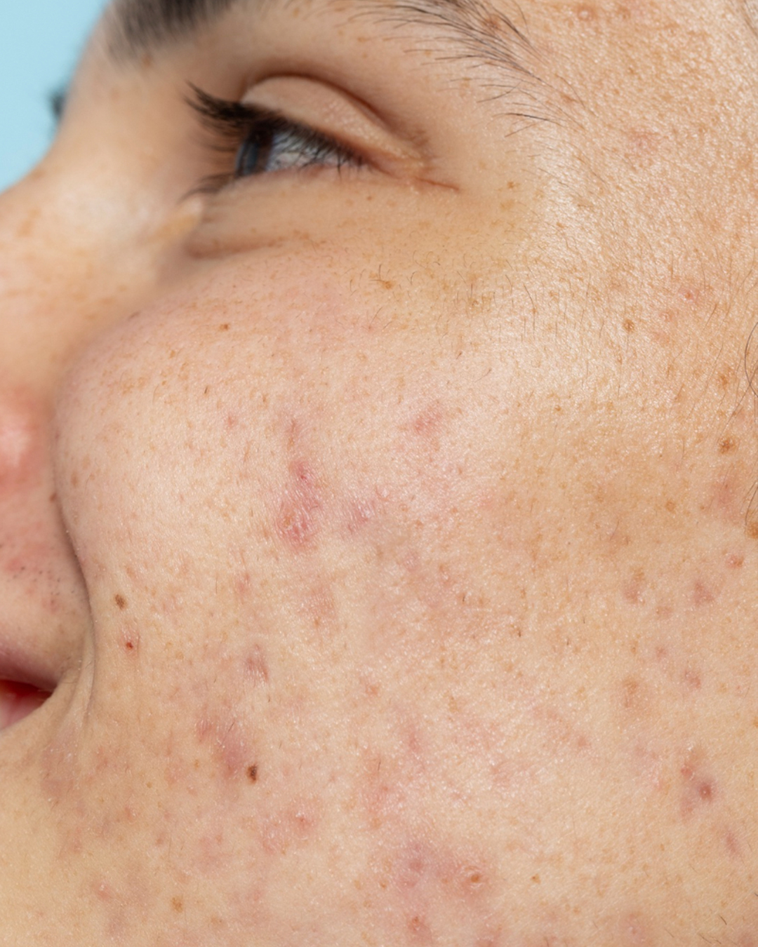 Mega Menu Banner7784