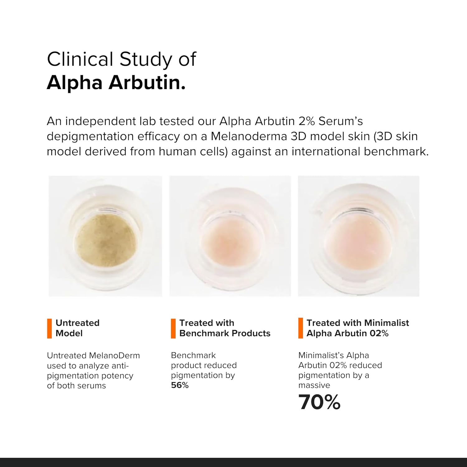 Alpha Arbutin (5) Buy Alpha Arbutin 2% Face Serum in Nepal from Beautix Nepal. Target dark spots and uneven-looking skin tone with a lightweight brightening serum.