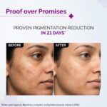 The Derma Co. Kojic Acid 30ml (2)