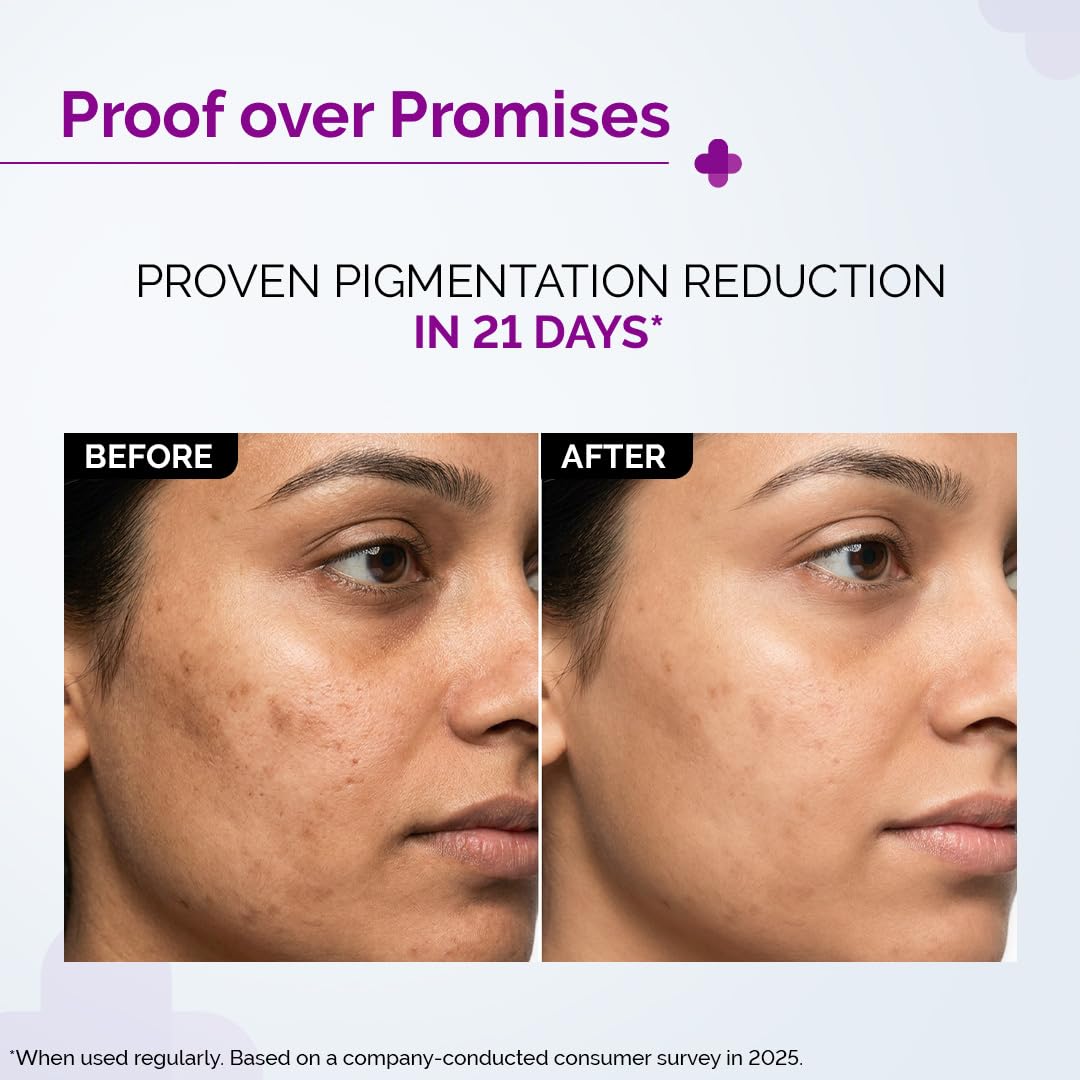The Derma Co. Kojic Acid 30ml (10) Buy The Derma Co 2% Kojic Acid Face Serum 30ml in Nepal from Beautix Nepal. Helps target dark spots, pigmentation and uneven-looking skin tone.