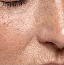 Aging