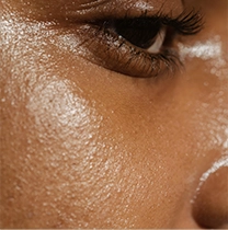 oily skin